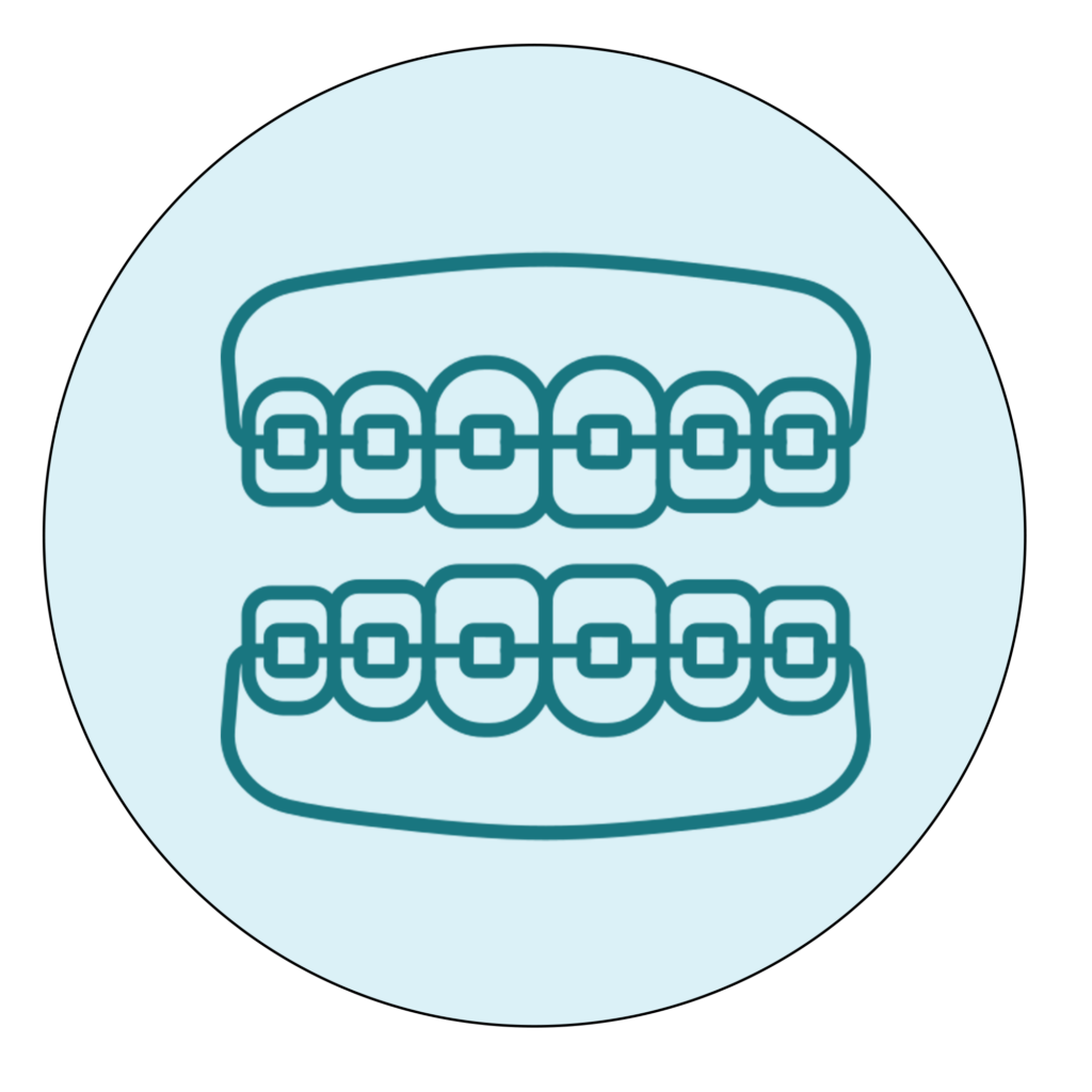 Traditional braces